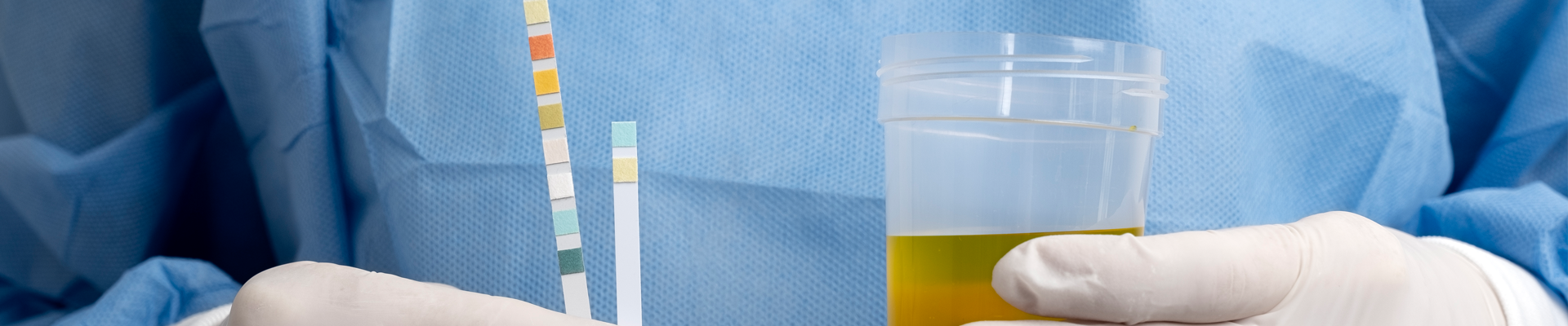 Dépistage urinaire à Sainte-Marie à la Clinique NR, accessible aussi depuis Scott, Saint-Isidore et Frampton.