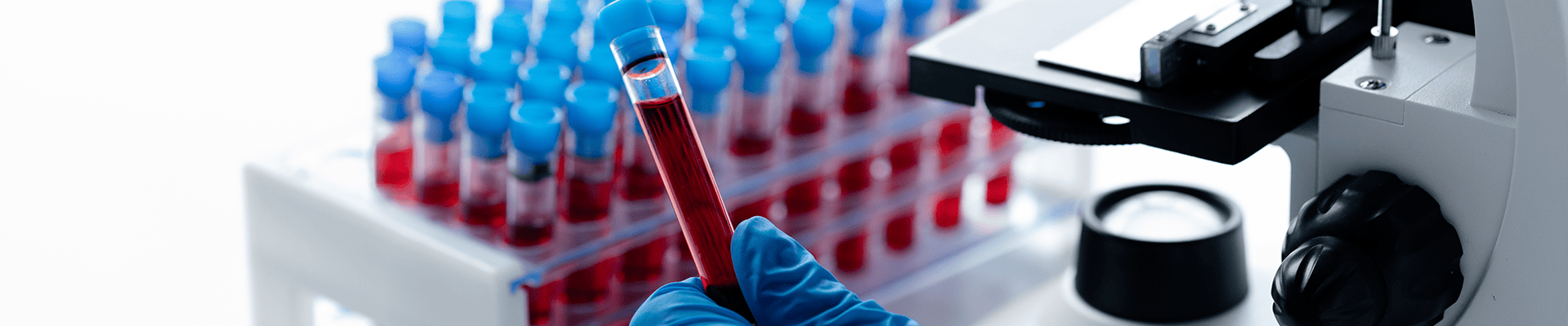 Analyse biomédicale en laboratoire à Sainte-Marie – Clinique NR, pour des résultats fiables et rapides.
